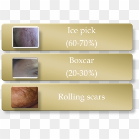 Retina Ice Pick Scars, HD Png Download - scar texture png