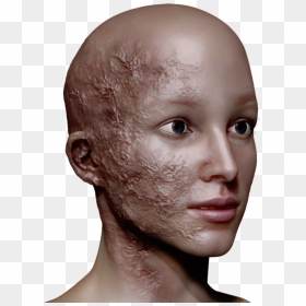 Human, HD Png Download - face scar png