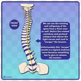 Scoliosis Effects On Nervous System, HD Png Download - nerves png