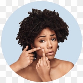 Scar - African American Blackhead Removal, HD Png Download - face scar png