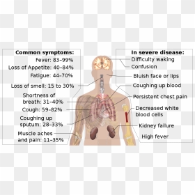 Coronavirus, HD Png Download - coughing png