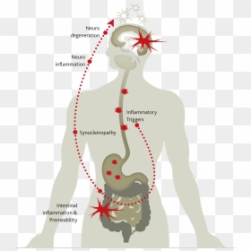 The Gut May Be At The Origin Of The Inflammation-driven - Illustration, HD Png Download - small intestine png