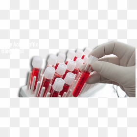 Keep Fat Related Health Problems In Check - Blood Test Tubes Png, Transparent Png - blood test png
