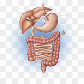 Vertical Sleeve Gastrectomy, HD Png Download - small intestine png