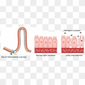 Leaky Gut, HD Png Download - small intestine png