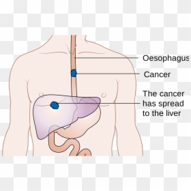 Am Worried About Esophagus Cancer, HD Png Download - esophagus png