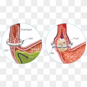 Esophagus Png, Transparent Png - esophagus png