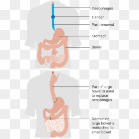 Illustration, HD Png Download - esophagus png
